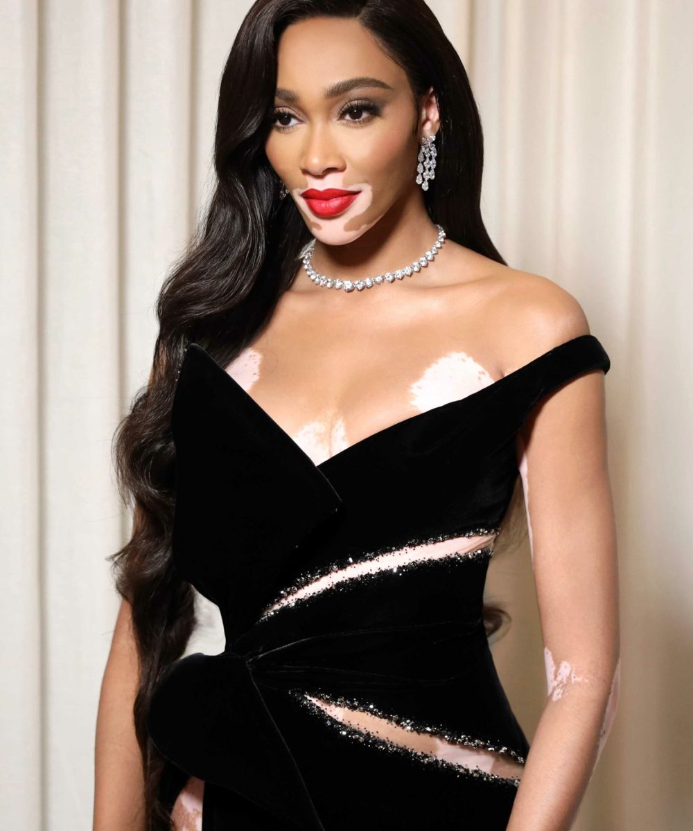 LOS ANGELES, CALIFORNIA - NOVEMBER 2: This is a dummy MEID for Los Angeles - Los Angeles - Rich Fury - Winnie Harlow (Photo by Rich fury/Getty Images for MTV)